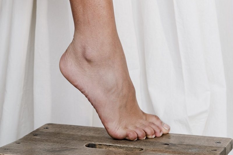 What Causes High Arches, and How Are They Treated